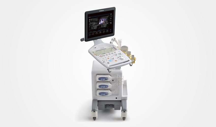 超音波診断装置（心エコー、腹部エコー、頸動脈エコー）